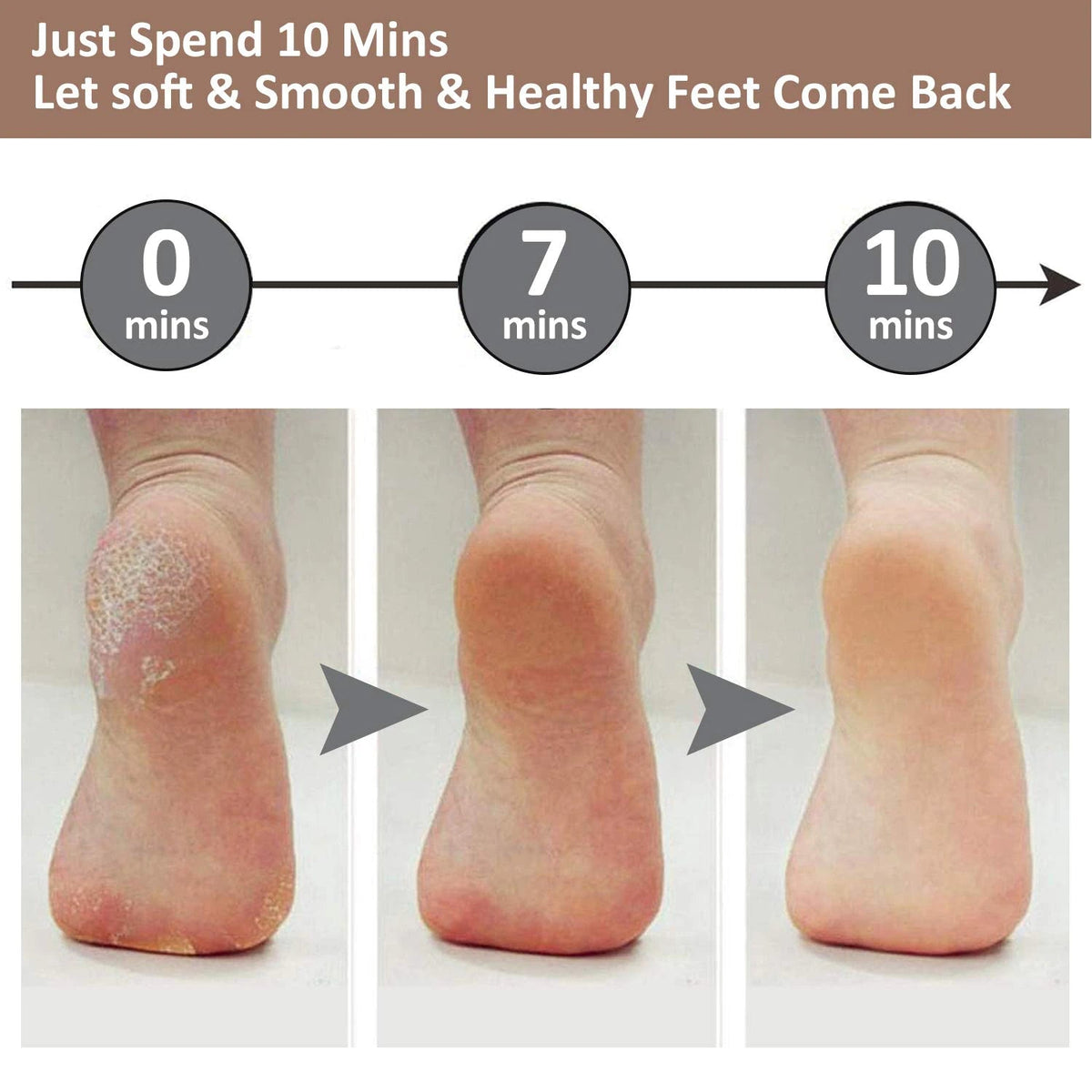 Electric Pedi Callus Remover / Callus Remover - SK Collection – SK Collection PK